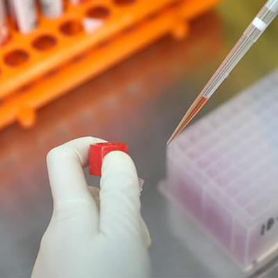 Kit per test PCR RT Monkeypox Virus MPXV Registrato CE 1 test/scatola